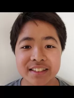 Lucas Lim